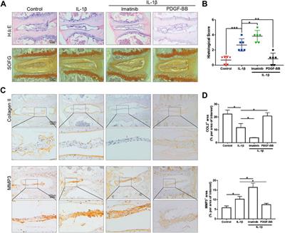 Platelet-Derived Growth Factor-BB Inhibits Intervertebral Disc Degeneration via Suppressing Pyroptosis and Activating the MAPK Signaling Pathway